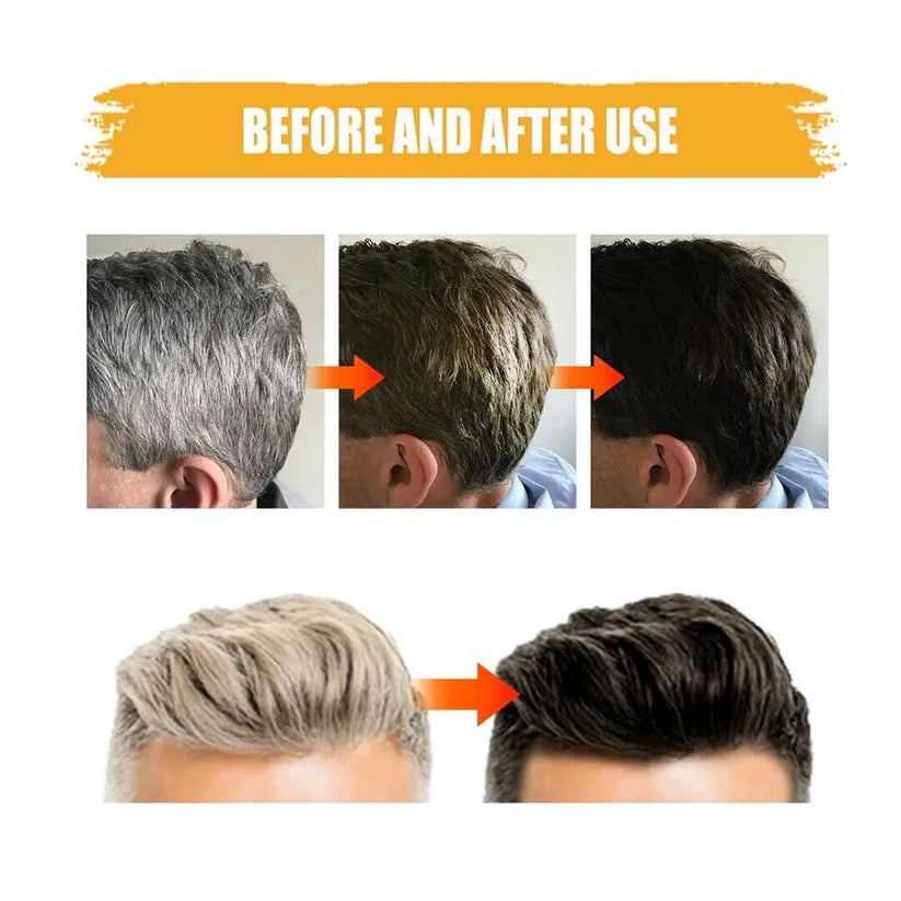 DarkBloom – Shampoo Sólido Restaurador Anticanas